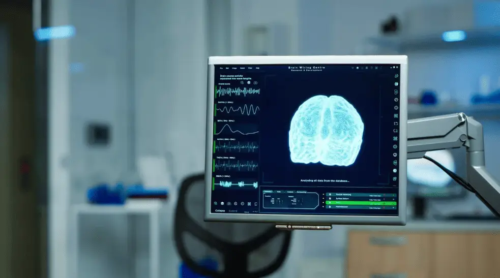 preguntas frecuentes sobre la neuromodulacion