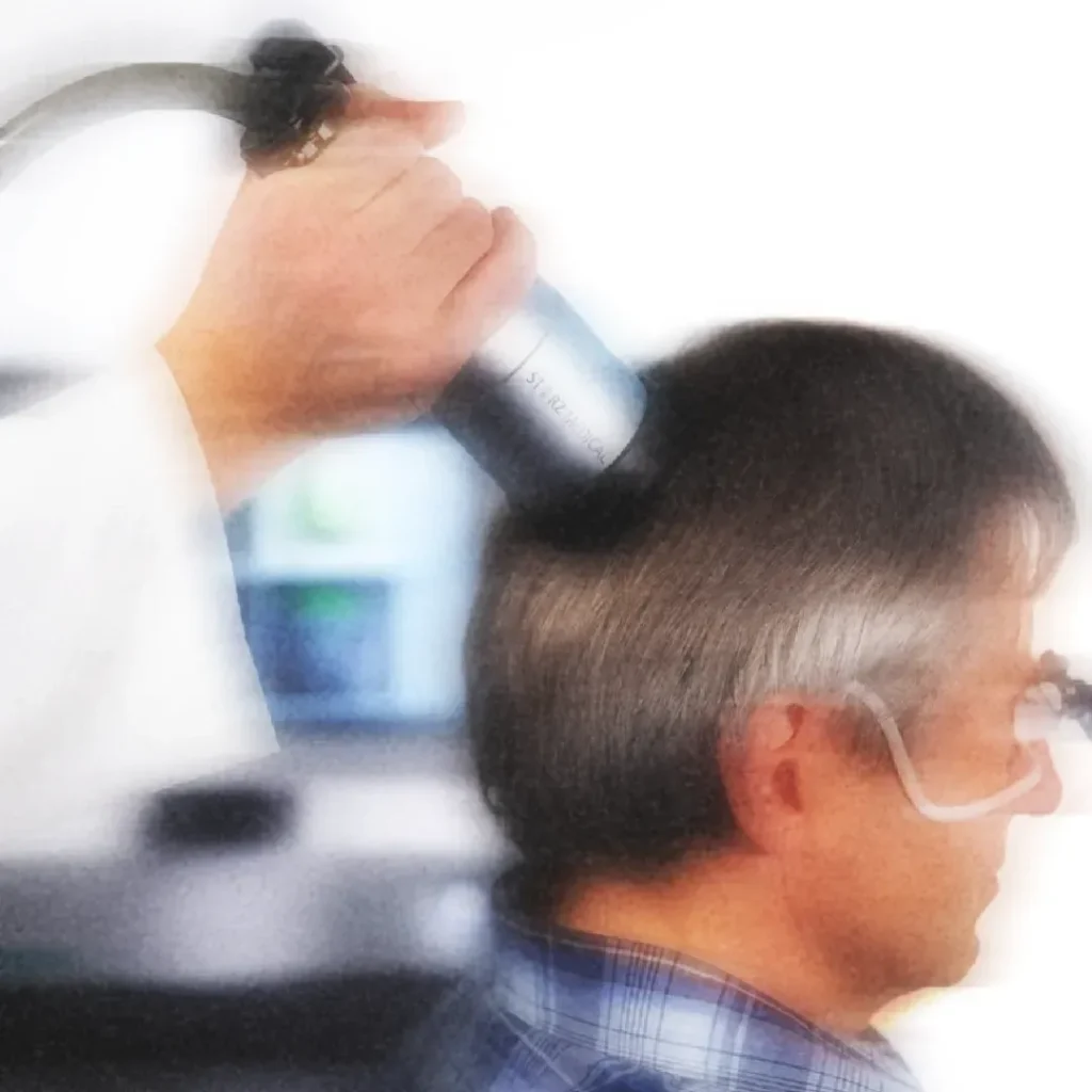 estimulacion cerebral no invasiva