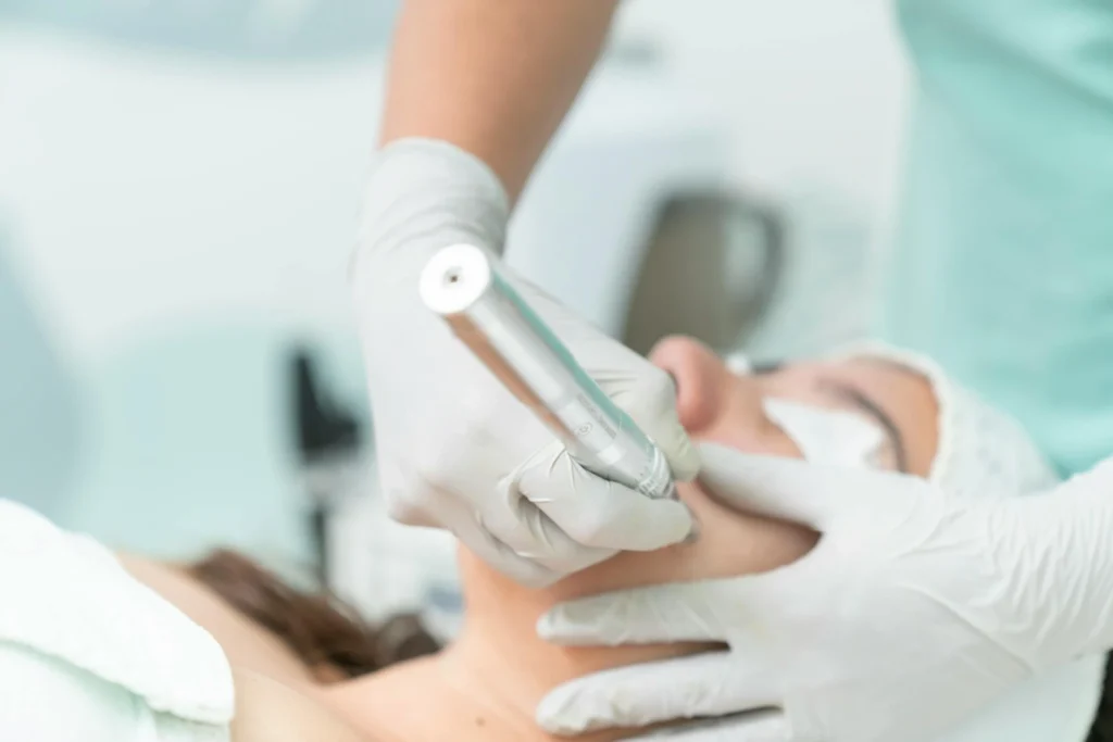 ¿Qué es el rejuvenecimiento facial y cómo funciona?